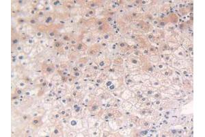 IHC-P analysis of Human Liver Tissue, with DAB staining. (POR 抗体  (AA 77-518))