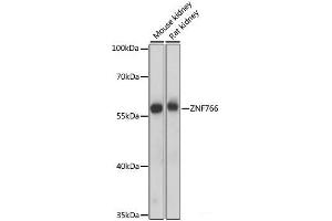Western blot analysis of extracts of various cell lines using ZNF766 Polyclonal Antibody at dilution of 1:1000. (ZNF766 抗体)