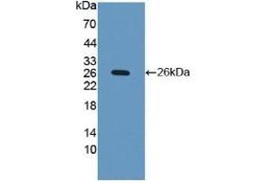 Detection of Recombinant iNV, Human using Polyclonal Antibody to Involucrin (INV) (Involucrin 抗体  (AA 36-152))