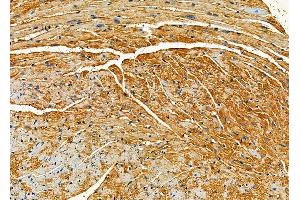 ABIN6264625 and ABIN6279750 at 1/100 staining mouse heart tissue by IHC-P.