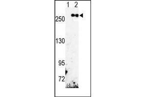 Western blot analysis of FASN (arrow) using rabbit polyclonal FASN Antibody (Fatty Acid Synthase 抗体  (Middle Region))