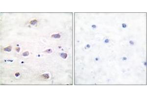 Immunohistochemistry analysis of paraffin-embedded human brain, using NMDAR1 (Phospho-Ser897) Antibody. (GRIN1/NMDAR1 抗体  (pSer897))