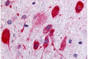 Anti-GPR171 antibody  ABIN1048756 IHC staining of rat brain, neurons. (GPR171 抗体  (Cytoplasmic Domain))