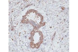 Immunohistochemistry of paraffin-embedded Human breast using TGFBR2 Polyclonal Antibody at dilution of 1:100 (40x lens). (TGFBR2 抗体)