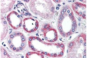 Human Kidney (formalin-fixed, paraffin-embedded) stained with PTK7 antibody ABIN343895 at 5 ug/ml followed by biotinylated goat anti-rabbit IgG secondary antibody ABIN481713, alkaline phosphatase-streptavidin and chromogen. (PTK7 抗体  (C-Term))