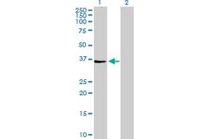 Western Blot analysis of AGPAT4 expression in transfected 293T cell line by AGPAT4 MaxPab polyclonal antibody. (AGPAT4 抗体  (AA 1-378))
