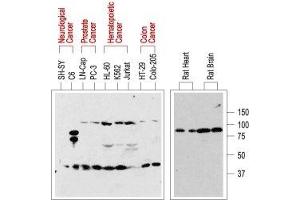Western blot analysis of normal rat tissue (right) and in human cancer cell lines (left):p75NTR is visualized with Anti-p75 NGF Receptor (extracellular) Antibody (ABIN7043344, ABIN7044755 and ABIN7044756), (1:200). (Nerve Growth Factor Receptor (NGFR) Peptide)