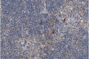 ABIN6266462 at 1/200 staining human lymph node tissue sections by IHC-P. (RIPK2 抗体  (pSer176))