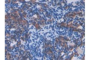 Detection of IL13Ra2 in Mouse Ovary Tissue using Polyclonal Antibody to Interleukin 13 Receptor Alpha 2 (IL13Ra2) (IL13RA2 抗体  (AA 228-338))