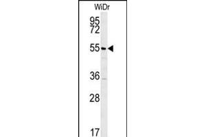 TSPYL4 Antibody (N-term) (ABIN652012 and ABIN2840495) western blot analysis in WiDr cell line lysates (35 μg/lane). (TSPY-Like 4 抗体  (N-Term))