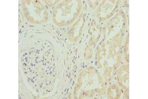 Immunohistochemistry of paraffin-embedded human kidney tissue using ABIN7175594 at dilution of 1:100 (CACNB1 抗体  (AA 429-598))