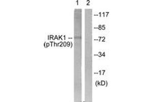 Western blot analysis of extracts from HeLa cells, using IRAK1 (Phospho-Thr209) Antibody. (IRAK1 抗体  (pThr209))