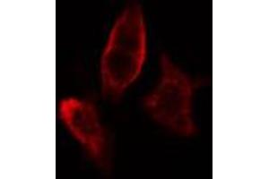 ABIN6267611 staining HeLa cells by IF/ICC. (LIPE 抗体  (pSer554, pSer855))
