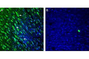 Expression of 5HT2A Receptor in rat cingulate cortex. (HTR2A 抗体  (Extracellular, N-Term))