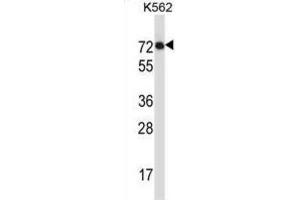 Western Blotting (WB) image for anti-Interleukin 1 Receptor-Like 2 (IL1RL2) antibody (ABIN2997308) (IL1RL2 抗体)