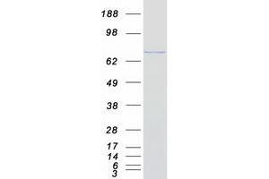 Validation with Western Blot