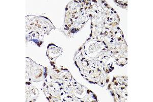 Immunohistochemistry of paraffin-embedded human placenta using TBX20 Rabbit pAb (ABIN7270698) at dilution of 1:100 (40x lens). (TBX20 抗体  (AA 1-290))