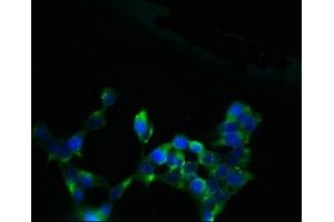 Immunofluorescent analysis of 293 cells using ABIN7170098 at dilution of 1:100 and Alexa Fluor 488-congugated AffiniPure Goat Anti-Rabbit IgG(H+L) (SLC13A4 抗体  (AA 134-273))