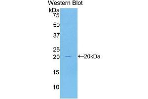 Detection of Recombinant CDKN2A, Human using Polyclonal Antibody to Cyclin Dependent Kinase Inhibitor 2A (CDKN2A) (CDKN2A 抗体  (AA 8-156))