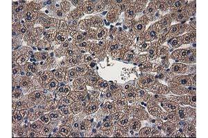 Image no. 4 for anti-ADP-Ribosylation Factor GTPase Activating Protein 1 (ARFGAP1) antibody (ABIN1496679)