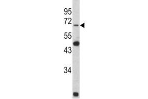 Western blot analysis of Lamin B2 antibody and Y79 lysate (Lamin B2 抗体  (AA 476-504))