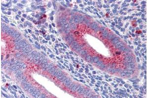 Uterus: Formalin-Fixed, Paraffin-Embedded (FFPE) (MFN1 抗体  (AA 745-756))