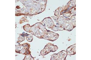 Immunohistochemistry of paraffin-embedded mouse spleen using Caspase-9 Rabbit pAb (ABIN6131534, ABIN6137975, ABIN6137977 and ABIN6213766) at dilution of 1:50 (40x lens).