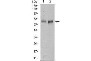 Western Blotting (WB) image for anti-Activated Leukocyte Cell Adhesion Molecule (ALCAM) (AA 405-524) antibody (ABIN1098107)