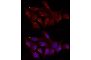 Immunofluorescence (IF) image for anti-Gastrin-Releasing Peptide (GRP) (AA 1-148) antibody (ABIN6141433)