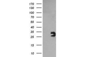 Image no. 1 for anti-Glioblastoma Amplified Sequence (GBAS) antibody (ABIN1498394) (GBAS 抗体)
