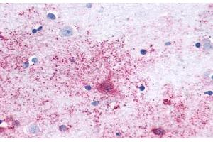 Anti-MAS1 antibody  ABIN1049039 IHC staining of human brain, neurons and glia. (MAS1 抗体  (Cytoplasmic Domain))