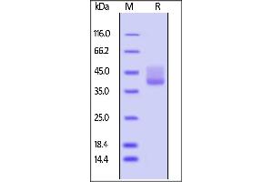Human BAFFR, Fc Tag on  under reducing (R) condition. (TNFRSF13C Protein (AA 7-71) (Fc Tag))