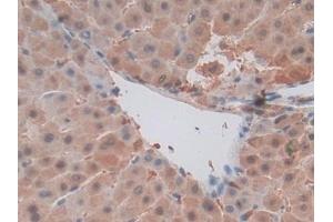 Immunohistochemistry (IHC) image for anti-Macrophage Migration Inhibitory Factor (Glycosylation-Inhibiting Factor) (MIF) (AA 3-111) antibody (ABIN7432415)