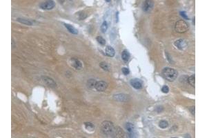 Detection of TGFa in Human Esophagus Tissue using Monoclonal Antibody to Transforming Growth Factor Alpha (TGFa) (TGFA 抗体  (AA 24-98))