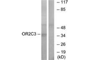 Western blot analysis of extracts from COLO cells, using OR2C3 Antibody. (OR2C3 抗体  (AA 231-280))