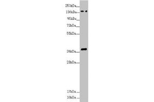 Western blot All lanes: SFI1 antibody at 4. (SFI1 抗体  (AA 1003-1242))