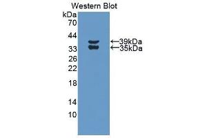 Western Blotting (WB) image for anti-Complement Fragment 3a (C3a) (AA 671-748) antibody (ABIN3208724) (C3a 抗体  (AA 671-748))