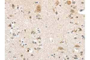 The image on the left is immunohistochemistry of paraffin-embedded Human brain tissue using ABIN7193032(VSIG10 Antibody) at dilution 1/45, on the right is treated with synthetic peptide. (VSIG1 抗体)