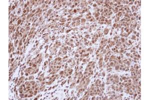 IHC-P Image Immunohistochemical analysis of paraffin-embedded SAS Xenograft , using Topoisomerase II alpha , antibody at 1:500 dilution. (Topoisomerase II alpha 抗体  (C-Term))