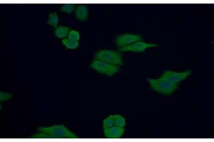 Detection of Trx in Human MCF7 cell using Polyclonal Antibody to Thioredoxin (Trx) (TXN 抗体  (AA 1-105))