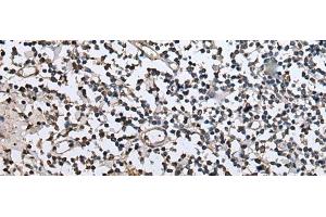 Immunohistochemistry of paraffin-embedded Human tonsil tissue using ZFP36 Polyclonal Antibody at dilution of 1:40(x200) (ZFP36 抗体)