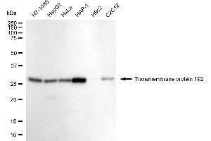 anti-Transmembrane Protein 192 (TMEM192) antibody
