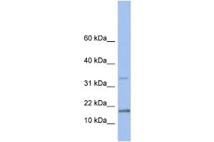 WB Suggested Anti-TCL1A Antibody Titration: 0. (TCL1A 抗体  (N-Term))