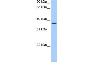 WB Suggested Anti-ALKBH8 Antibody Titration:  0. (ALKBH8 抗体  (N-Term))