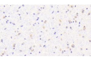 Detection of IBA1 in Mouse Cerebrum Tissue using Polyclonal Antibody to Ionized Calcium-binding Adapter Molecule 1 (IBA1) (Iba1 抗体  (AA 35-102))