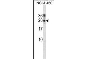 RAT Ppp1r2 Antibody (Center) (ABIN1881680 and ABIN2839055) western blot analysis in NCI- cell line lysates (35 μg/lane). (PPP1R2 抗体  (AA 49-77))