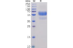 SDS-PAGE (SDS) image for CD70 Molecule (CD70) (AA 39-193) protein (Fc-His Tag) (ABIN6961169)