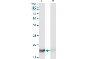 Western Blot analysis of TSC22D1 expression in transfected 293T cell line by TSC22D1 monoclonal antibody (M06), clone 2E2. (TSC22D1 抗体  (AA 1-144))