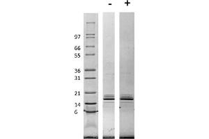SDS-PAGE of Rat Monocyte Chemotactic Protein-1 (CCL2) Recombinant Protein SDS-PAGE of Rat Monocyte Chemotactic Protein-1 (CCL2) Recombinant Protein. (CCL2 蛋白)