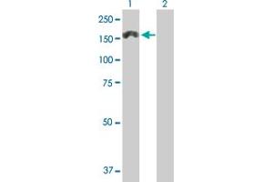 Western Blot analysis of MTMR3 expression in transfected 293T cell line by MTMR3 MaxPab polyclonal antibody. (MTMR3 抗体  (AA 1-1198))